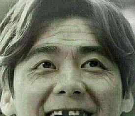 明星缺牙,揭秘明星口腔健康与美丽