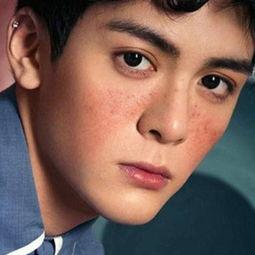 男明星雀斑,探寻男明星雀斑之美